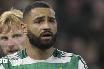 Cameron Carter-Vickers injury: The Celtic defender could be out until March