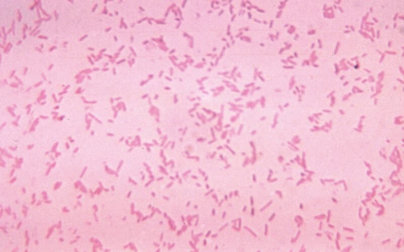 Antibiotic resistance is rising at an alarming rate : Goats and Soda : NPR