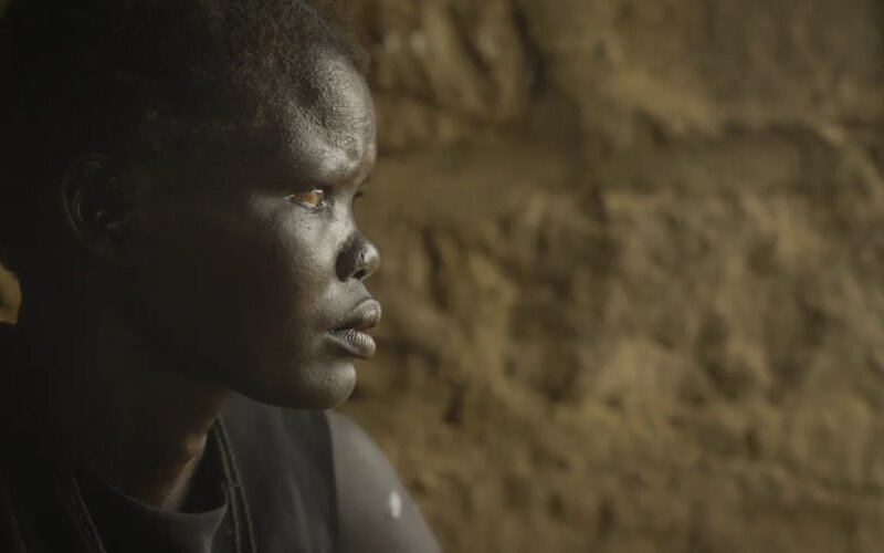 The Shutdown of U.S.A.I.D. Has Already Killed Hundreds of Thousands