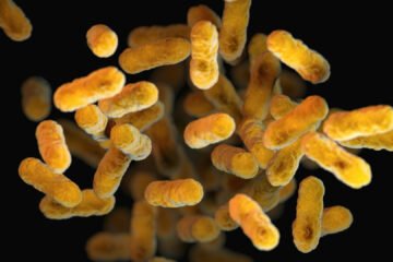 In Louisiana, a Slower Response to Whooping Cough