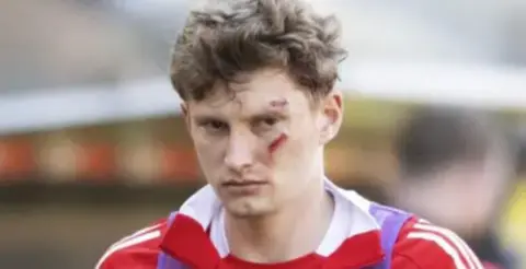 SNS Jack McKenzie wearing a red and white football shirt. He has two wounds on his face