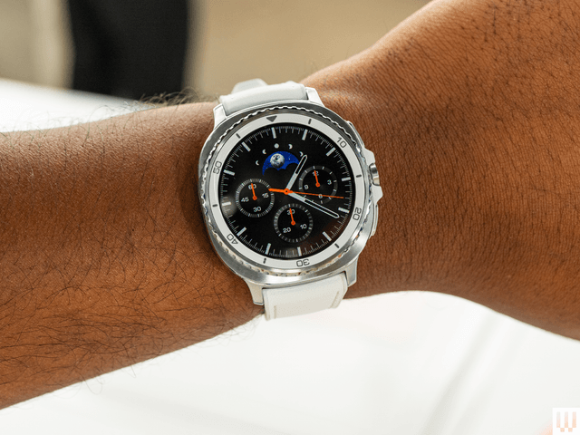 Image may contain: watch, arm, body part and person