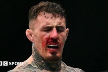 UFC: Michael Bisping tells Tom Aspinall to ignore the hype surrounding his career after eye surgery