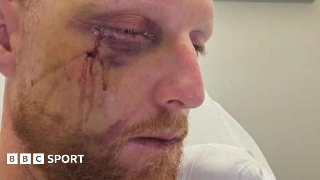 Ben Stokes: England Test captain undergoes surgery on his fractured cheek