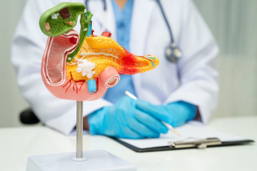 Human anatomy model of the pancreas, gallbladder, and bile duct with a doctor in the background.