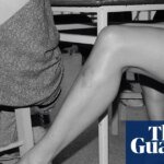 “Arms and legs are very expressive, especially with bruises”: the absurdist photography of Yorgos Lanthimos | Photography