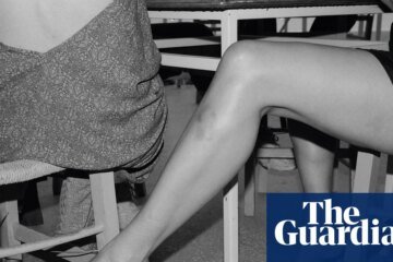 “Arms and legs are very expressive, especially with bruises”: the absurdist photography of Yorgos Lanthimos | Photography