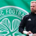Kasper Schmeichel: The Celtic goalkeeper could have played his final game with two operations required