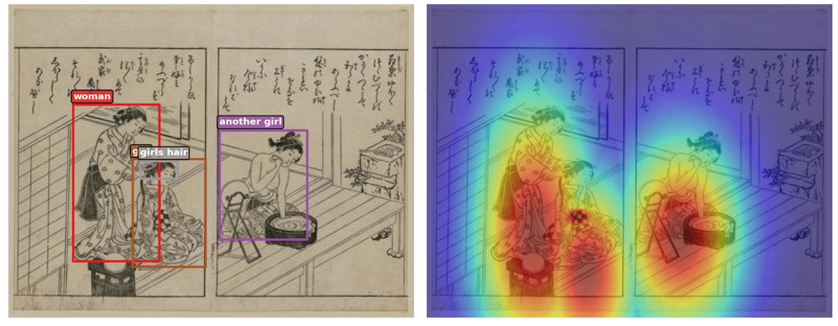 Expert spatial annotations: bounding boxes converted to gaussian heatmaps guide the model to focus on specific regions