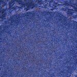 Japan approves the world’s first treatment made from reprogrammed human cells