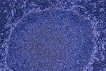 Japan approves the world’s first treatment made from reprogrammed human cells