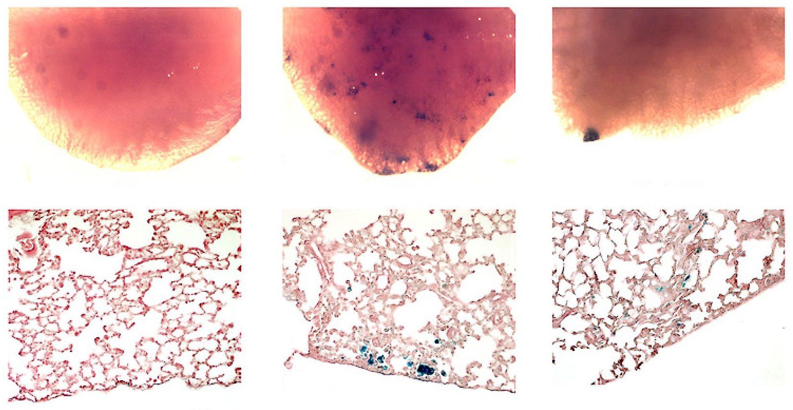 Three sets of images comparing highly magnified tissue samples.